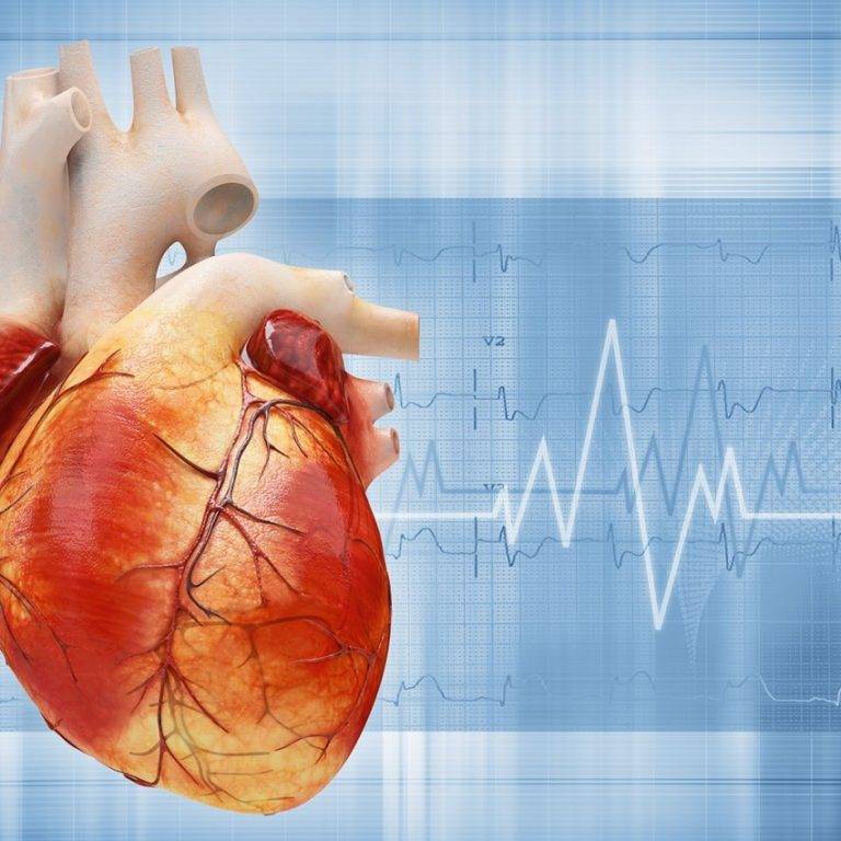 Стенокардия — риск инфаркта: что делать во время приступа? | здорова и красива