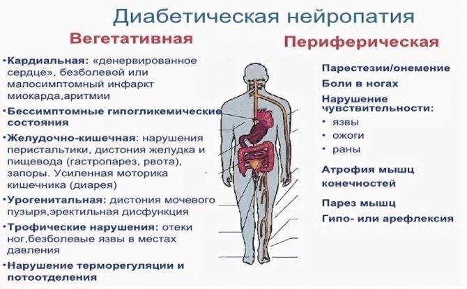 Диабетическая полинейропатия нижних конечностей: симптомы, лечение, препараты - sammedic.ru