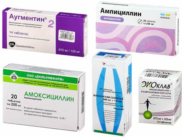 Антибиотики при ангине: список препаратов в таблетках для взрослых и детей