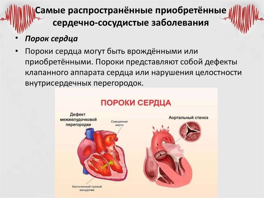 Список болезней сердца и сердечно-сосудистой системы: расписание и классификация заболеваний