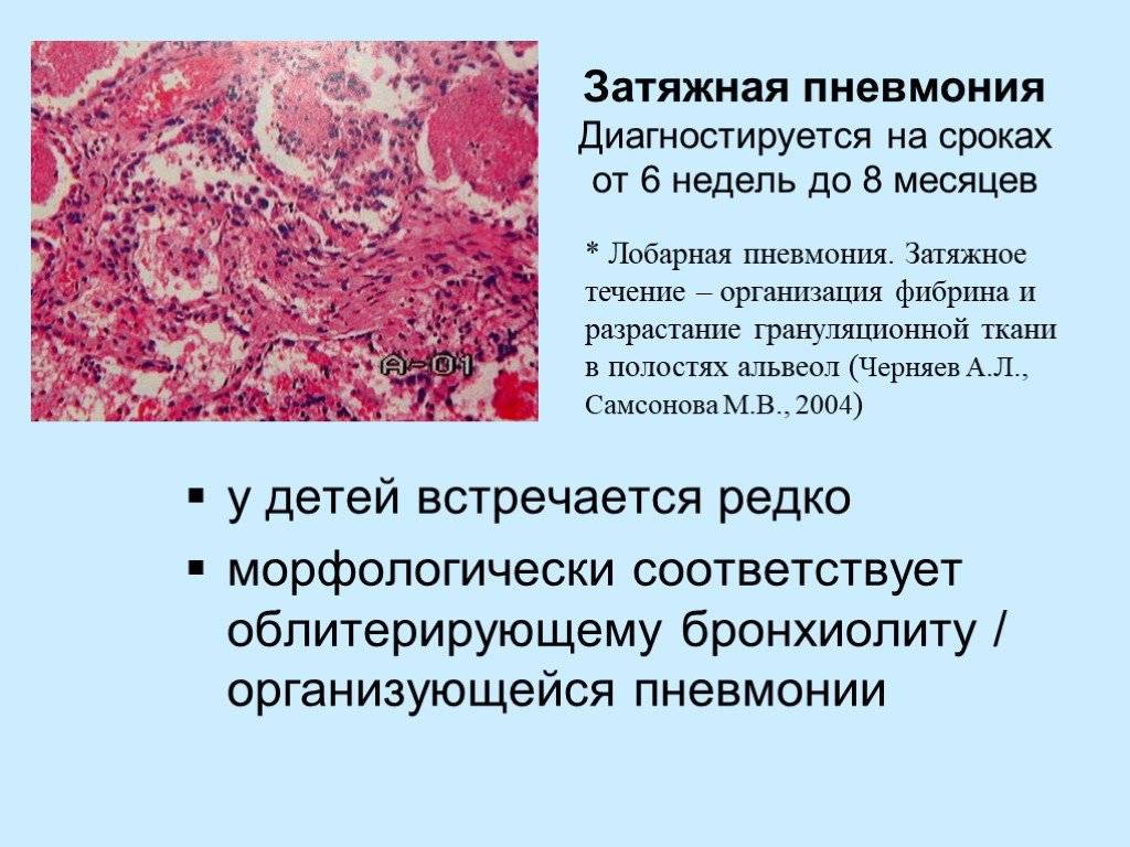 Затяжная пневмония – отличительные характеристики, как протекает, правила организации диагностики и лечения | pnevmonya.ru