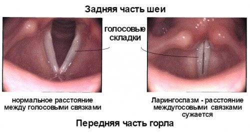 Как восстановить голос после простуды или сильной нагрузки на связки? - горлонос.ру
