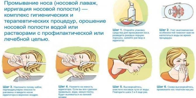Мирамистин при гайморите: как использовать промывание для лечения носа