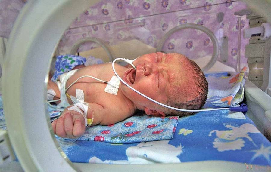 Внутриутробная пневмония у новорожденных: причины и последствия