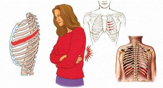 Боль слева под ребрами сзади со спины: причины, сопутствующие симптомы, лечение боли в левом подреберье, отдающей в спину