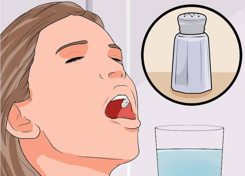 Полоскание горла солью: рецепт приготовления и правильное лечение