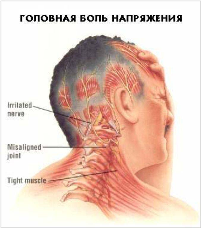 Болит голова при кашле: причины и лечение