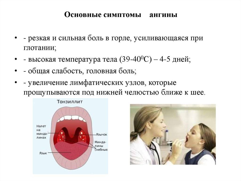 Комаровский – боль в горле, горло красное, что делать, если у ребенка рыхлое горло, лечение