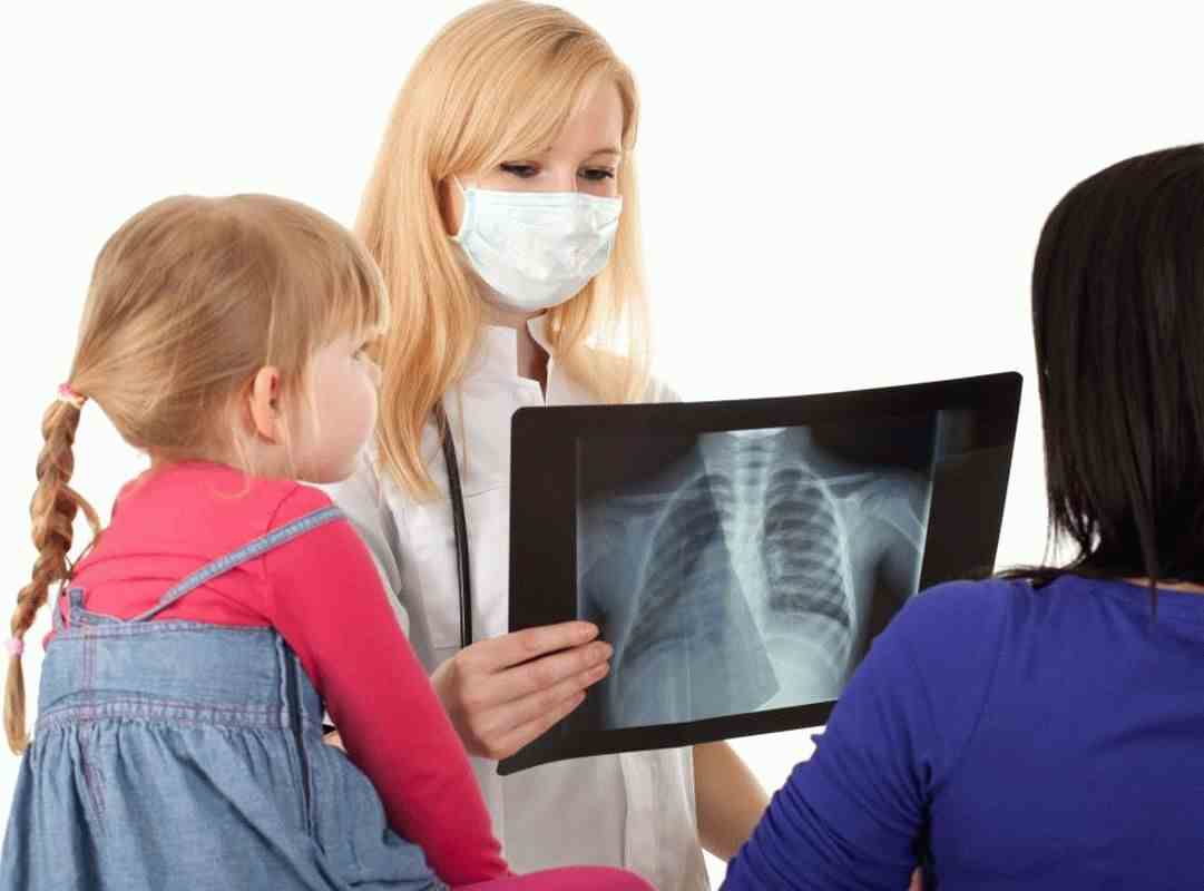 Симптомы и причины туберкулеза у детей, профилактика и лечение