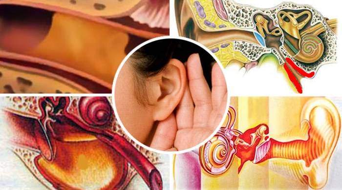 Отит после орви: осложнения на ухо у ребенка, ухудшился слух