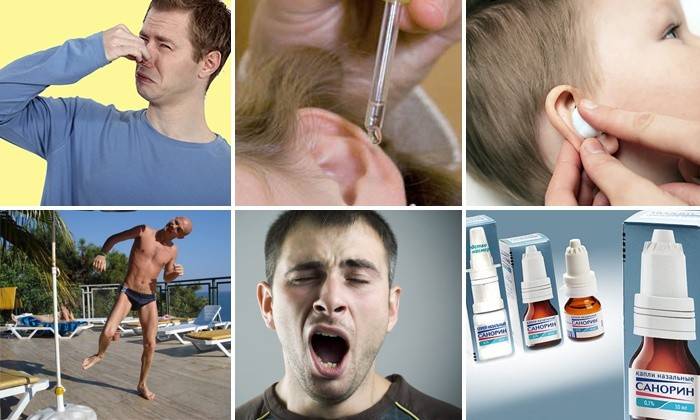 Что делать, если заложило уши после самолета: при насморке или с болью