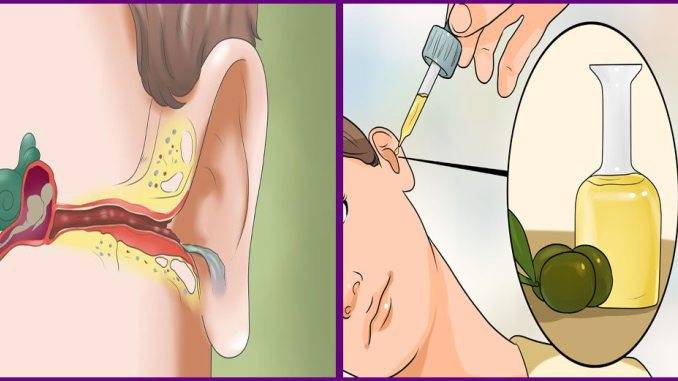Заложенность уха без боли