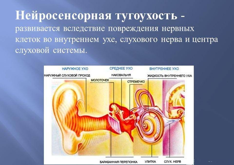 Тугоухость 2 степени – лечение у взрослых: восстановится ли слух