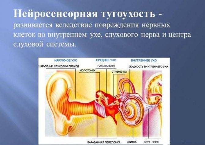 Тугоухость | симптомы | диагностика | лечение - docdoc.ru