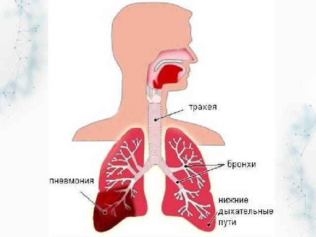 Пневмония симптомы у детей с температурой и кашлем симптомы и лечение