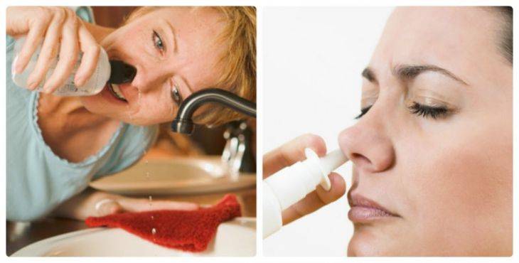 Как избавиться от аллергического насморка: 8 способов как промывать нос в домашних условиях, как навсегда вылечить ринит, как лечить при аллергии