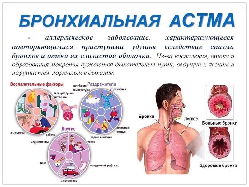 Первые признаки бронхиальной астмы
