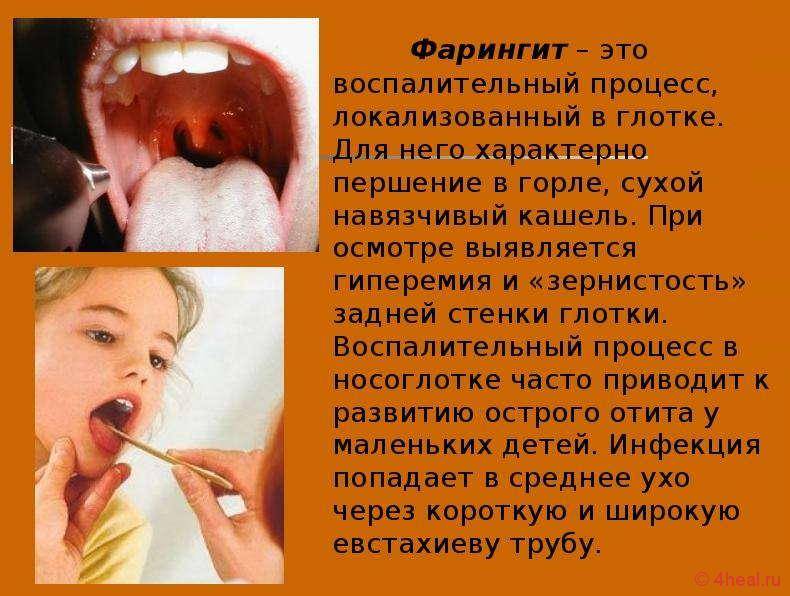 Субатрофический фарингит: симптомы и лечение pulmono.ru
субатрофический фарингит: симптомы и лечение