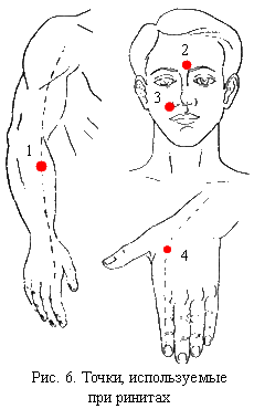 Техника выполнения точечного массажа при насморке