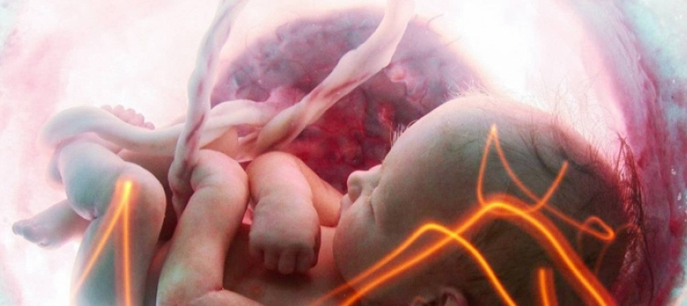 Внутриутробная пневмония у новорожденных: причины и последствия, лечение, признаки, прогноз, после кесарева