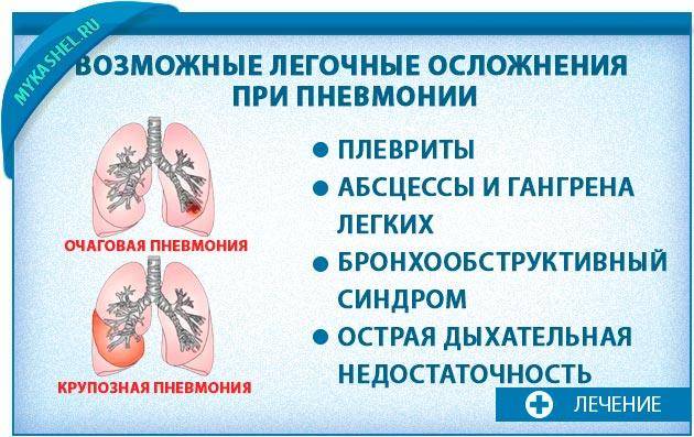 Сколько лечится воспаление лёгких (пневмония)?