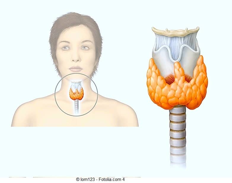 Лечим тиреотоксикоз щитовидной железы народными средствами