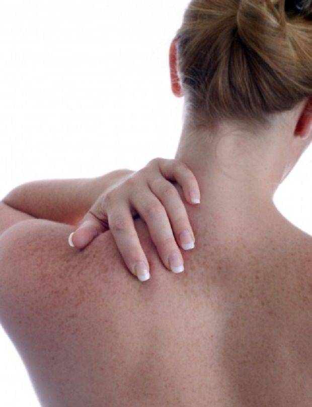 Шейный миозит: симптомы и лечение воспаления шейных мышц