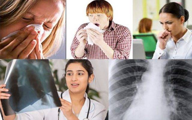 Отличительные симптомы туберкулеза на ранней стадии у взрослых