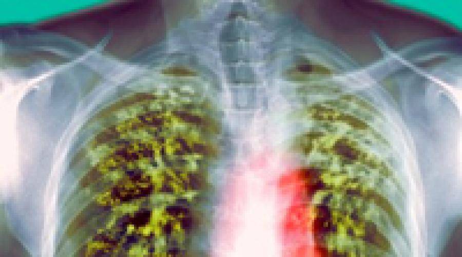 Излечим ли туберкулез легких полностью или нет?