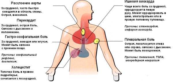Какая боль в грудной клетке при коронавирусе: как болит, если ли сдавленность и жжение