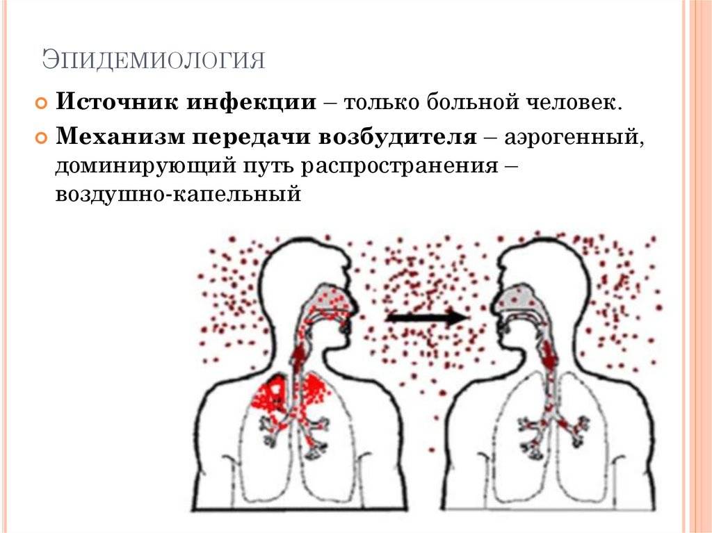 Ангина передается ли воздушно капельным - болезни горла