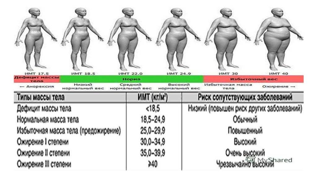 Что такое гиноидное ожирение?