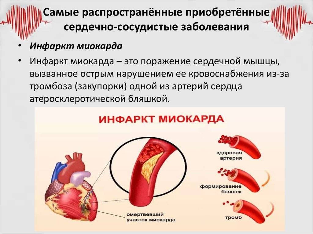 Болезни сердца и сосудов, справочник заболеваний сердечно-сосудистой системы