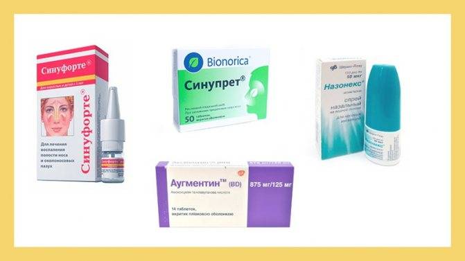 Синупрет при гайморите, насморке и заложенности носа: лечение таблетками и сиропом