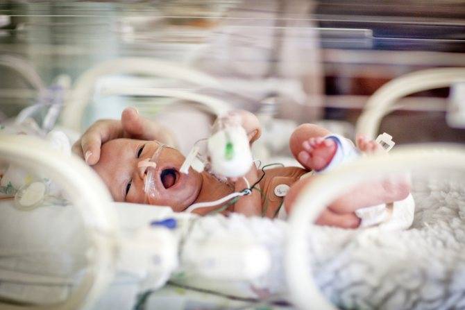 Сколько лечится пневмония у новорожденных: лечение у недоношенных, как долго лечится, как лечить у новорожденного