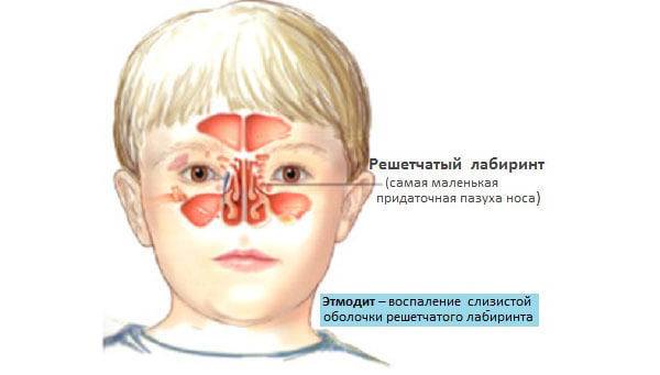 Воспаление пазухи носа: симптомы. лечение. как установить причину?