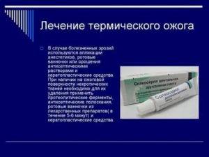 Химический ожог кожи: симптомы и лечение народными средствами | kazandoctor.ru