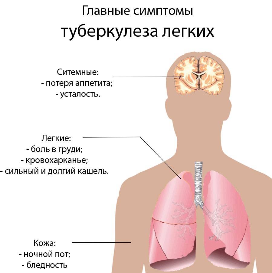 Симптомы и первые признаки туберкулеза, причина заболевания, как определить таберкулез