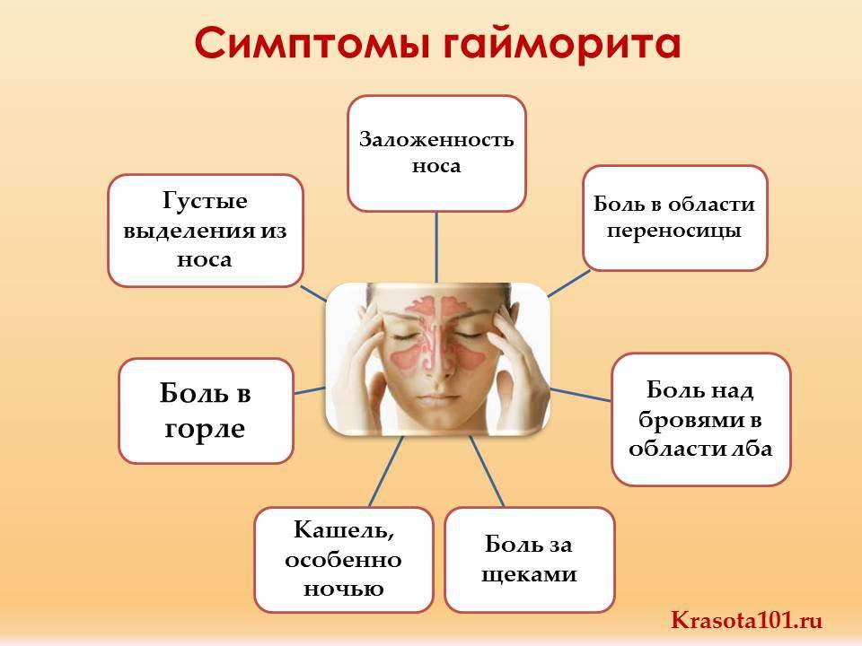 Гайморит - симптомы у взрослых без температуры: лечение насморка в домашних условиях, признаки без заложенности носа и соплей