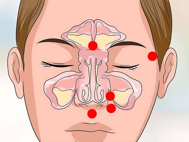 Заложенность носа без насморка у взрослых: причины и лечение