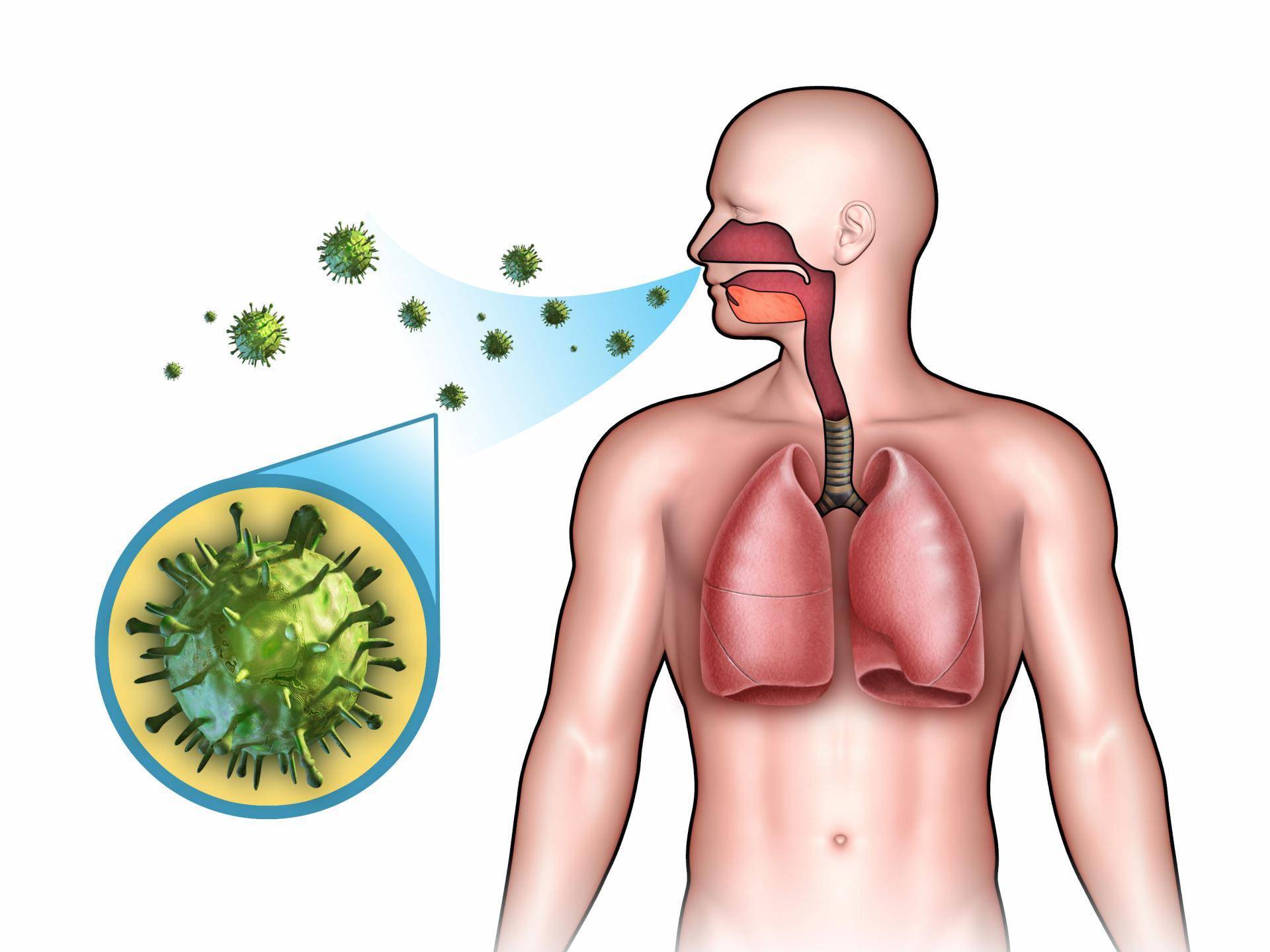Пневмония заразна или нет и как она передается человеку