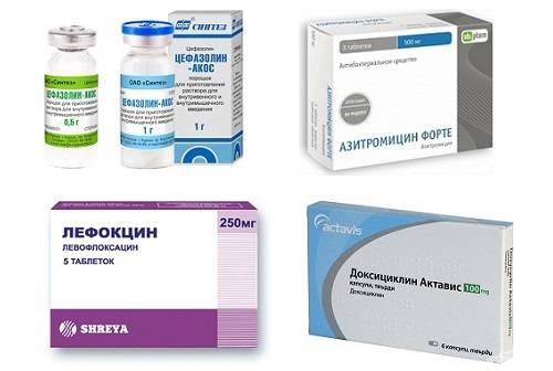 20 самых эффективных антибиотиков для лечения кашля