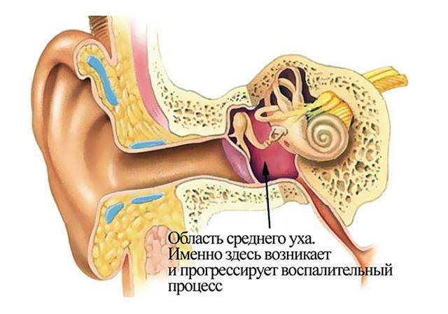 Заложило ухо – как снять заложенность и избавиться от шума без боли