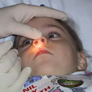 У ребенка 3 года заложен нос капли не помогают что делать