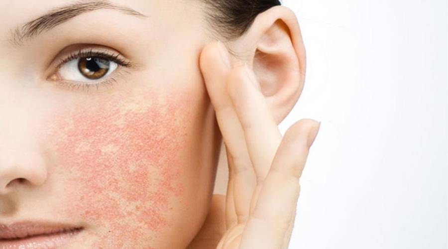 Сухая кожа - симптом заболевания или вполне нормальное явление?