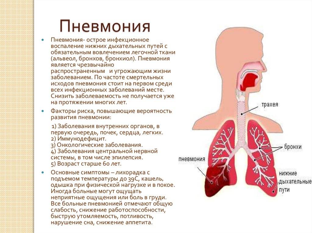 Признаки и симптомы пневмонии у детей без температуры pulmono.ru
признаки и симптомы пневмонии у детей без температуры