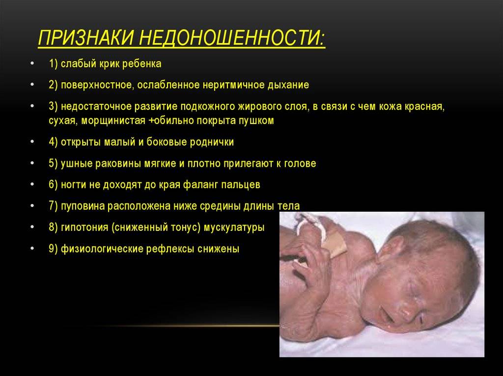 Пневмония у новорожденных после родов: последствия