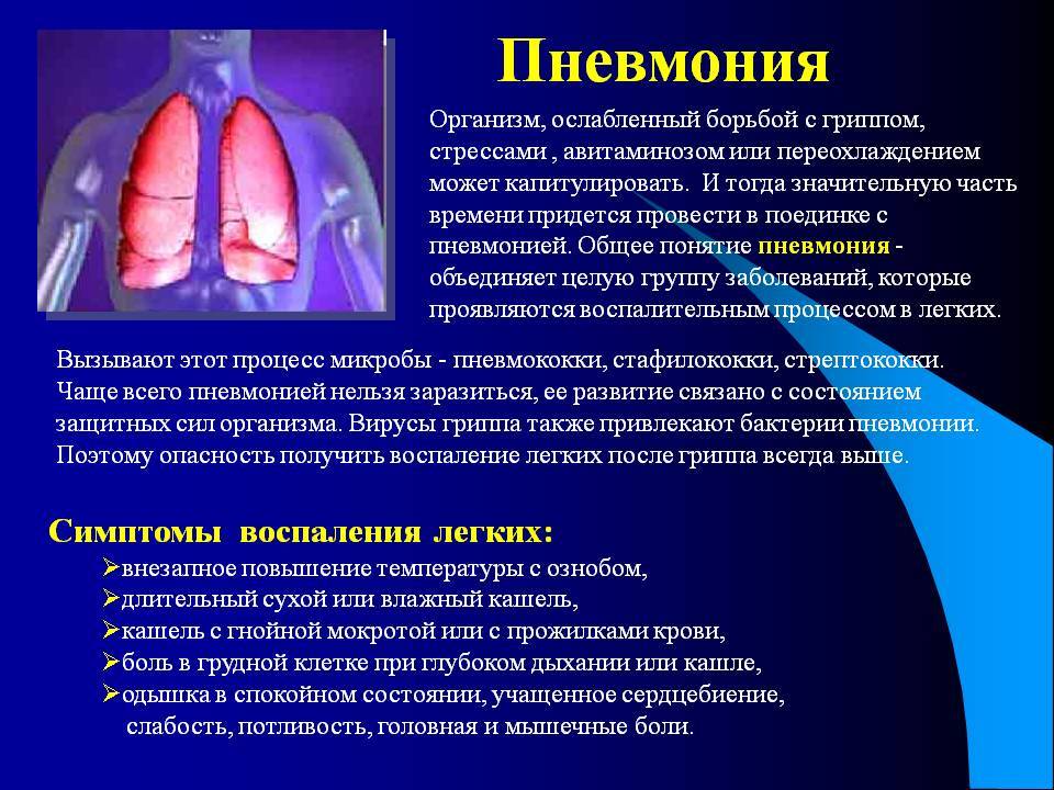 Пневмония без кашля – причины, методы лечения
