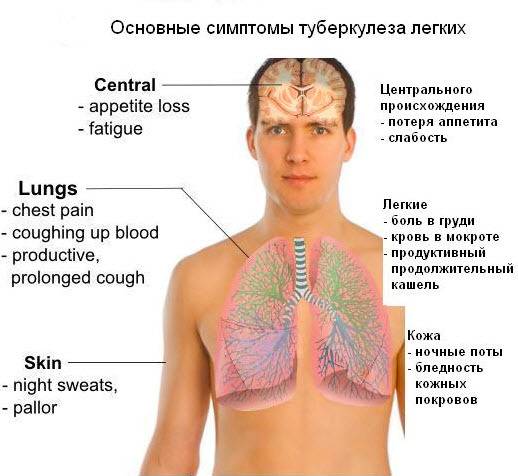Туберкулёз лёгких – виды и формы заболевания