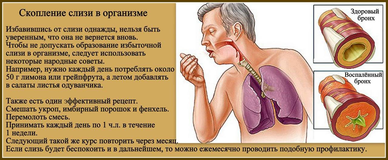 Мокрота в горле - с кашлем и без, причины и лечение